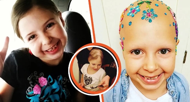 7 jähriges Mädchen mit plötzlichem Haarausfall findet Schönheit in der Glatze, indem sie ihren Kopf schmückt